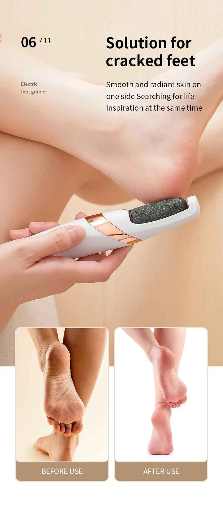 Rechargeable Automatic Foot Grinder Electric – Pedicure Callus & Dead Skin Remover